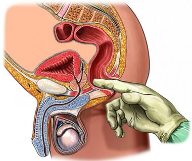 Digital prostate review