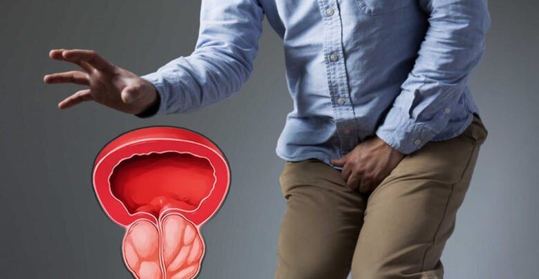 Prostatitis prevention and prostate adenoma